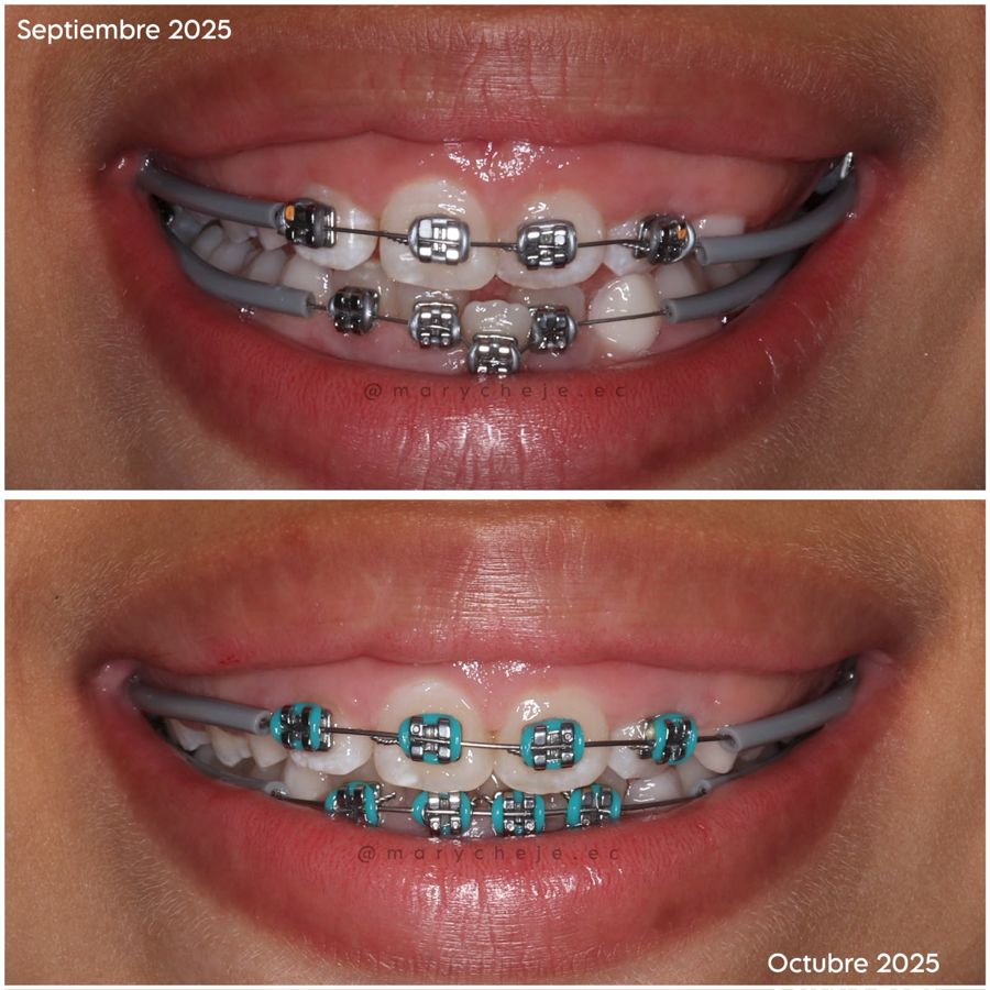 Sonrisa en septiembre y en octubre de 2025